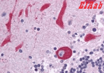 Human TLR7 Polyclonal Antibody