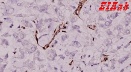Human LAMC1 Polyclonal Antibody