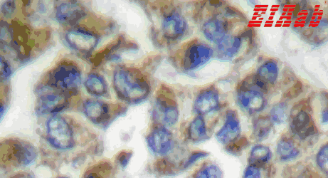 Human KRT16 Polyclonal Antibody