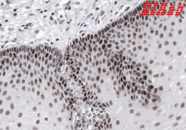 Human WRAP73 Polyclonal Antibody
