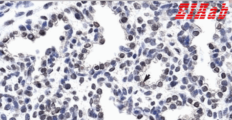 Human WNT2B Polyclonal Antibody