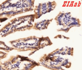 Human TMEM132D Polyclonal Antibody