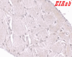 Human WNT10A Polyclonal Antibody