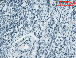 Human ZFP36 Polyclonal Antibody
