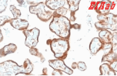 Human TYMP Polyclonal Antibody