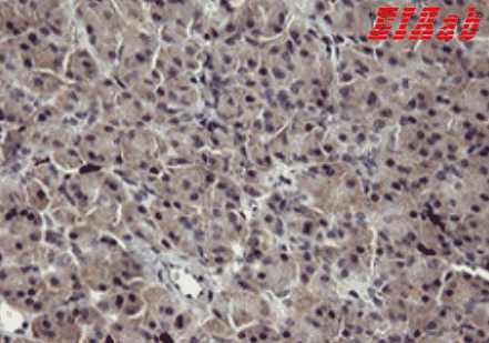 Human TNFRSF10B Polyclonal Antibody
