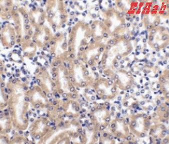 Human TNFRSF10D Polyclonal Antibody