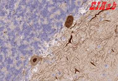 Human TRIM3 Polyclonal Antibody