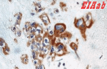 Human TNFAIP3 Polyclonal Antibody