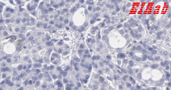 Human TYRP1 Polyclonal Antibody