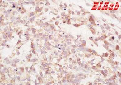 Human PAPPA Polyclonal Antibody