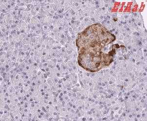 Human PCSK1N Polyclonal Antibody