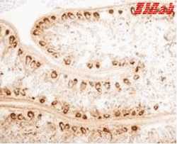 Human PLA2G2A Polyclonal Antibody