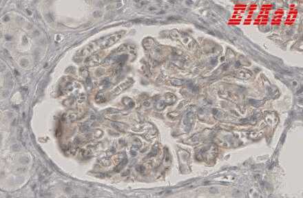 Human PLA2R1 Polyclonal Antibody