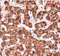 Human PLD2 Polyclonal Antibody