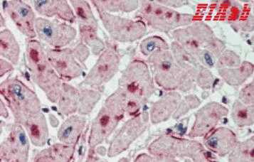 Human PNPLA2 Polyclonal Antibody