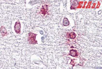 Human PPME1 Polyclonal Antibody