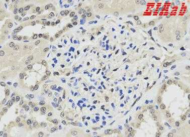 Human PPP1CA Polyclonal Antibody