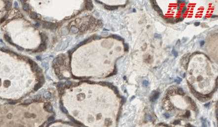 Human PRDX1 Polyclonal Antibody
