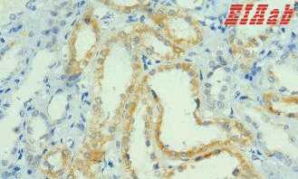 Human PRMT1 Polyclonal Antibody