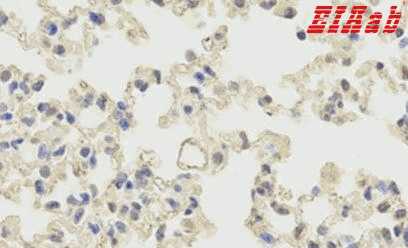 Human PRNP Polyclonal Antibody