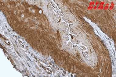 Human PTGES3 Polyclonal Antibody