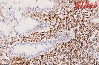 Human RARG Polyclonal Antibody