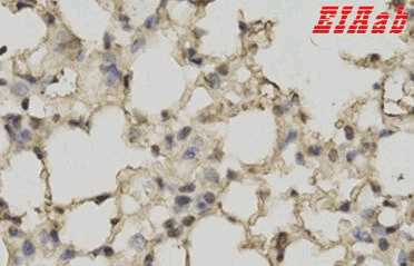 Human RBP4 Polyclonal Antibody