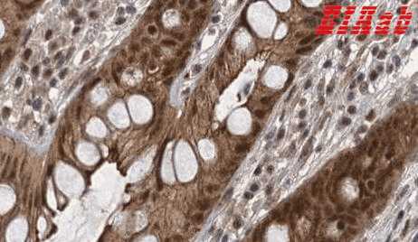 Human RITA1 Polyclonal Antibody