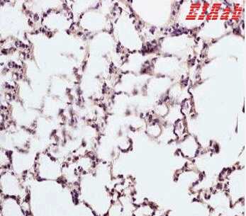 Human SFTPD Polyclonal Antibody
