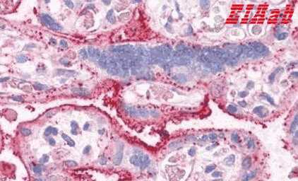 Human SLC31A1 Polyclonal Antibody