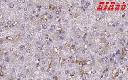 Human SLC40A1 Polyclonal Antibody