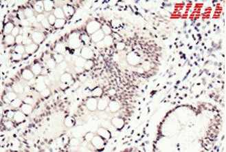 Human SMAD4 Polyclonal Antibody