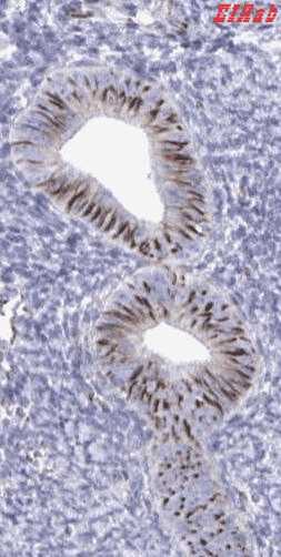 Human SMAD5 Polyclonal Antibody