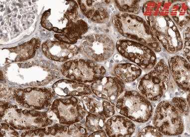 Human SMC4 Polyclonal Antibody