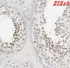Human STAT4 Polyclonal Antibody