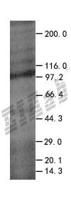 APAF1 293T Cell Transient Overexpression Lysate(Denatured)