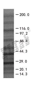BCAP29 293T Cell Transient Overexpression Lysate(Denatured)