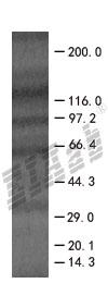 BCAP31 293T Cell Transient Overexpression Lysate(Denatured)