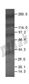 CASP3 293T Cell Transient Overexpression Lysate(Denatured)