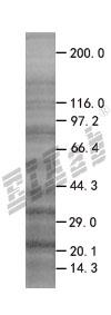 FAF1 293T Cell Transient Overexpression Lysate(Denatured)
