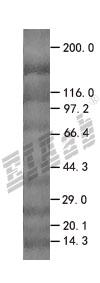 GLRX2 293T Cell Transient Overexpression Lysate(Denatured)