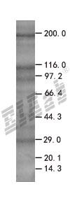 HTATIP2 293T Cell Transient Overexpression Lysate(Denatured)