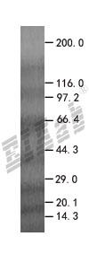 DNAJA3 293T Cell Transient Overexpression Lysate(Denatured)