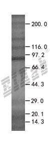ELMO1 293T Cell Transient Overexpression Lysate(Denatured)